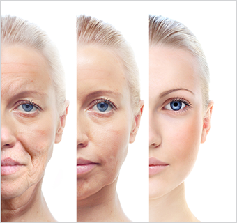 BDR - ilustracija efekta tretmana bdr dermaceuticima sa ciljem osvežavanja i podmlađivanja kože - anti aging
